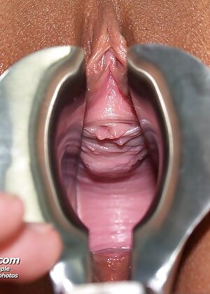 Terra Joy gyno